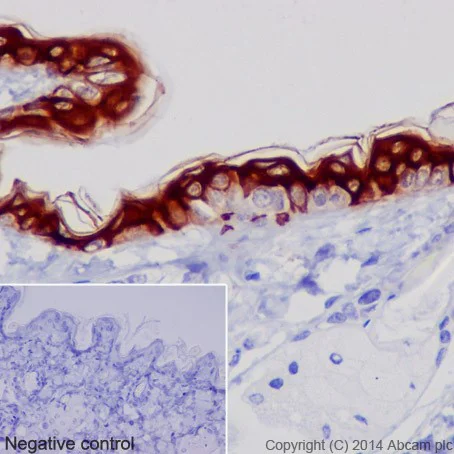 Immunohistochemistry (Formalin/PFA-fixed paraffin-embedded sections) - Anti-Cytokeratin 1 antibody [EPR17870] (AB185629)