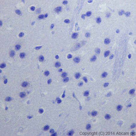 Immunohistochemistry (Formalin/PFA-fixed paraffin-embedded sections) - Anti-Cytokeratin 1 antibody [EPR17870] (AB185629), expandable thumbnail