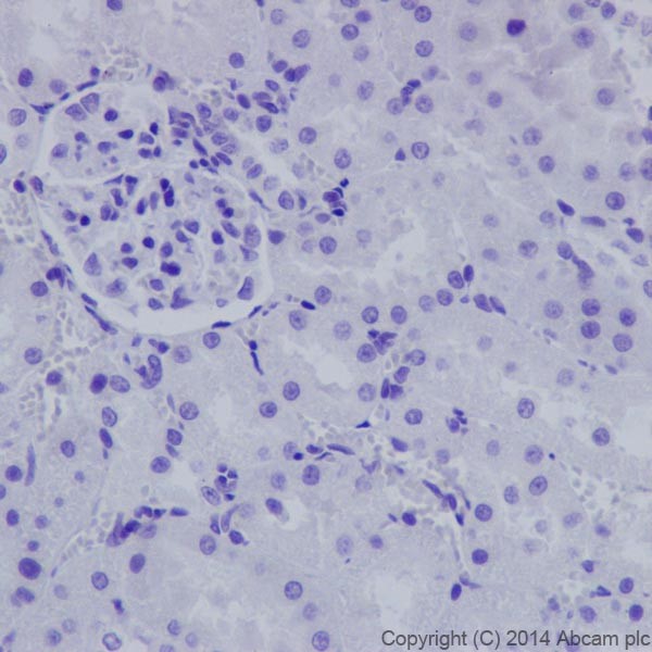 Immunohistochemistry (Formalin/PFA-fixed paraffin-embedded sections) - Anti-Cytokeratin 1 antibody [EPR17870] (AB185629), expandable thumbnail