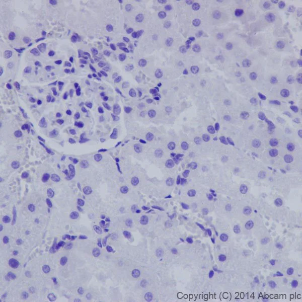 Immunohistochemistry (Formalin/PFA-fixed paraffin-embedded sections) - Anti-Cytokeratin 1 antibody [EPR17870] (AB185629)