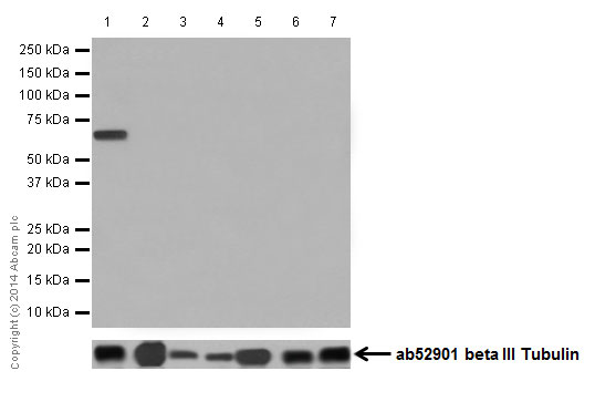 Western blot - Anti-Cytokeratin 1 antibody [EPR17870] (AB185629), expandable thumbnail