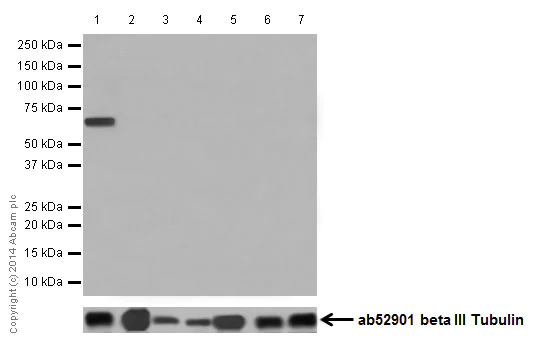 Western blot - Anti-Cytokeratin 1 antibody [EPR17870] (AB185629)