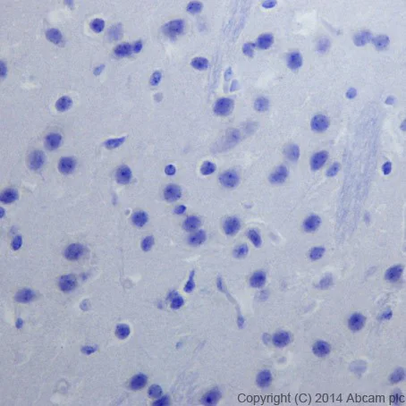 Immunohistochemistry (Formalin/PFA-fixed paraffin-embedded sections) - Anti-Cytokeratin 1 antibody [EPR17870] - BSA and Azide free (AB250845)
