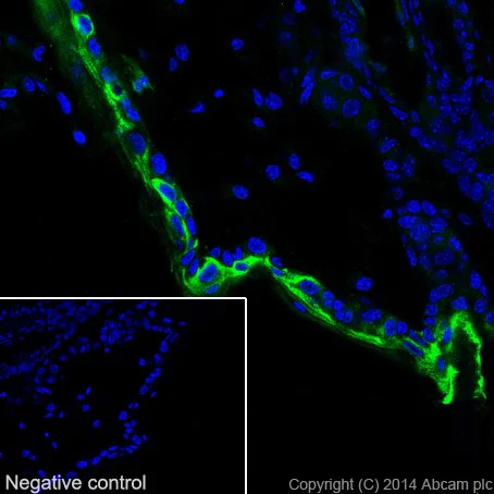 Immunohistochemistry (Frozen sections) - Anti-Cytokeratin 1 antibody [EPR17870] - BSA and Azide free (AB250845)