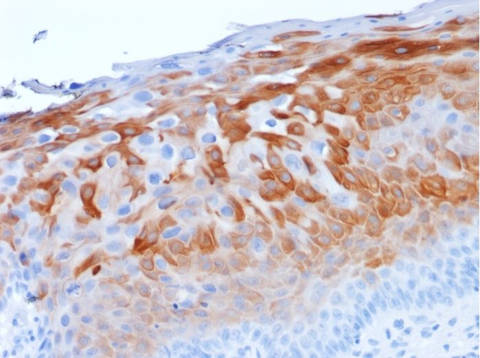 Immunohistochemistry (Formalin/PFA-fixed paraffin-embedded sections) - Anti-Cytokeratin 1 antibody [LHK1] (AB270243), expandable thumbnail