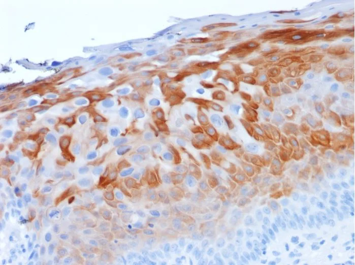 Immunohistochemistry (Formalin/PFA-fixed paraffin-embedded sections) - Anti-Cytokeratin 1 antibody [LHK1] (AB270243)