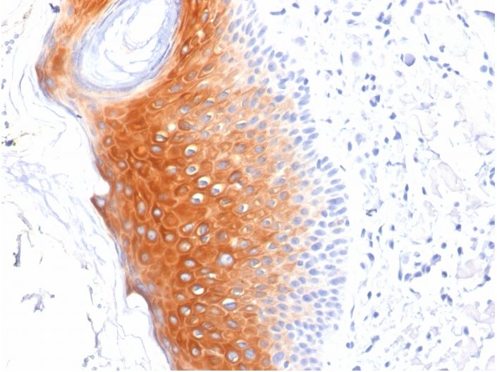 Immunohistochemistry (Formalin/PFA-fixed paraffin-embedded sections) - Anti-Cytokeratin 1 antibody [LHK1] (AB270243), expandable thumbnail