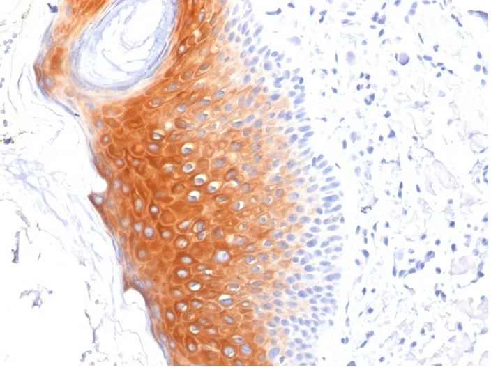 Immunohistochemistry (Formalin/PFA-fixed paraffin-embedded sections) - Anti-Cytokeratin 1 antibody [LHK1] - BSA and Azide free (AB270280)