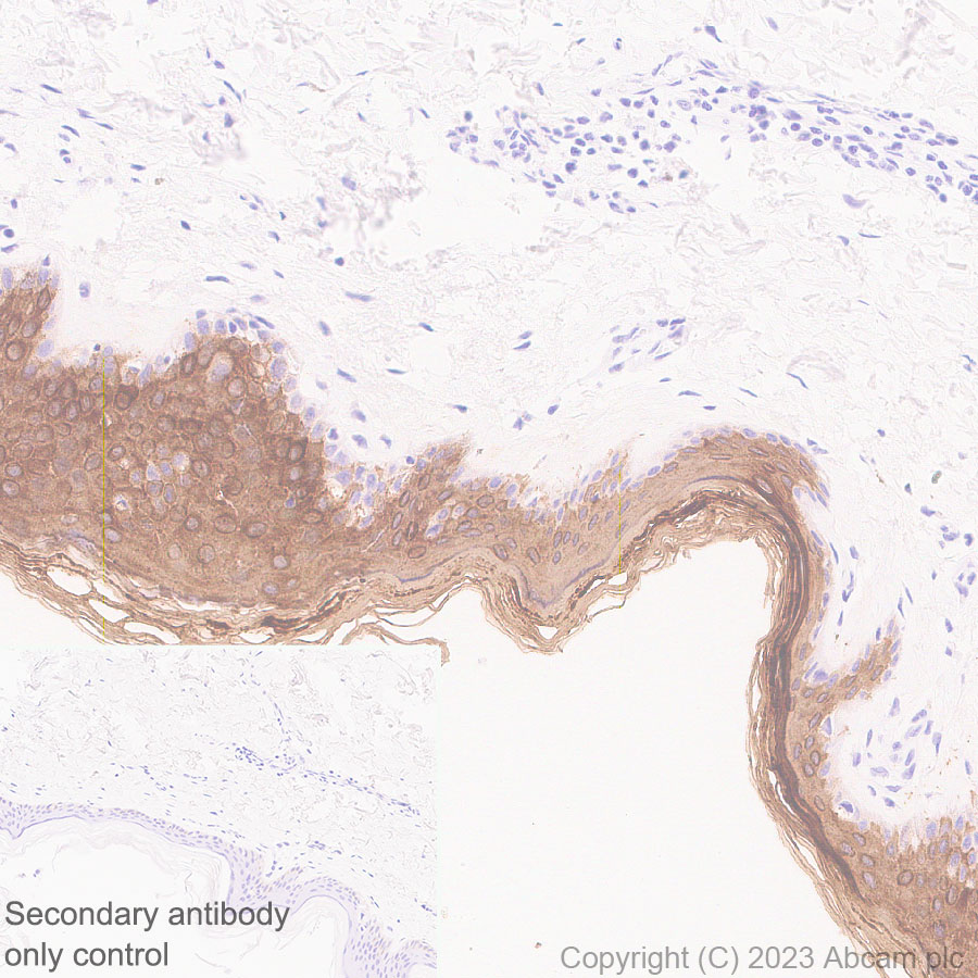 Immunohistochemistry (Formalin/PFA-fixed paraffin-embedded sections) - Anti-Cytokeratin 1 + Cytokeratin 2e antibody [EPR27257-91] (ab315228), expandable thumbnail