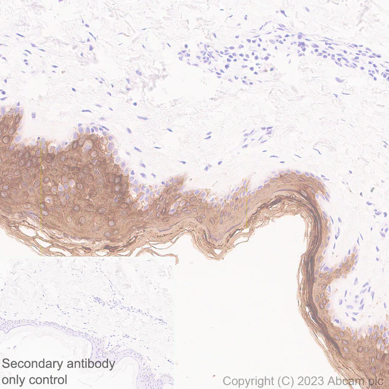 Immunohistochemistry (Formalin/PFA-fixed paraffin-embedded sections) - Anti-Cytokeratin 1 + Cytokeratin 2e antibody [EPR27257-91] (AB315228)