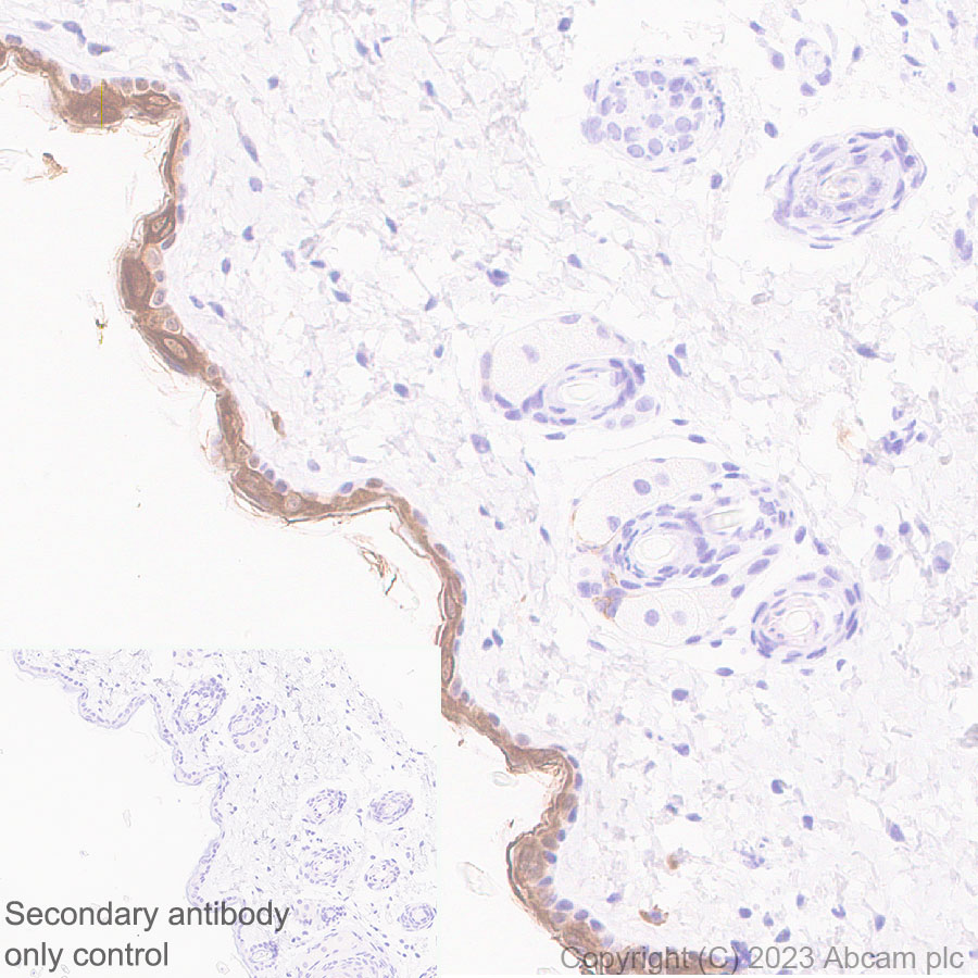 Immunohistochemistry (Formalin/PFA-fixed paraffin-embedded sections) - Anti-Cytokeratin 1 + Cytokeratin 2e antibody [EPR27257-91] (ab315228), expandable thumbnail