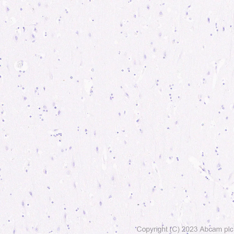 Immunohistochemistry (Formalin/PFA-fixed paraffin-embedded sections) - Anti-Cytokeratin 1 + Cytokeratin 2e antibody [EPR27257-91] (AB315228)