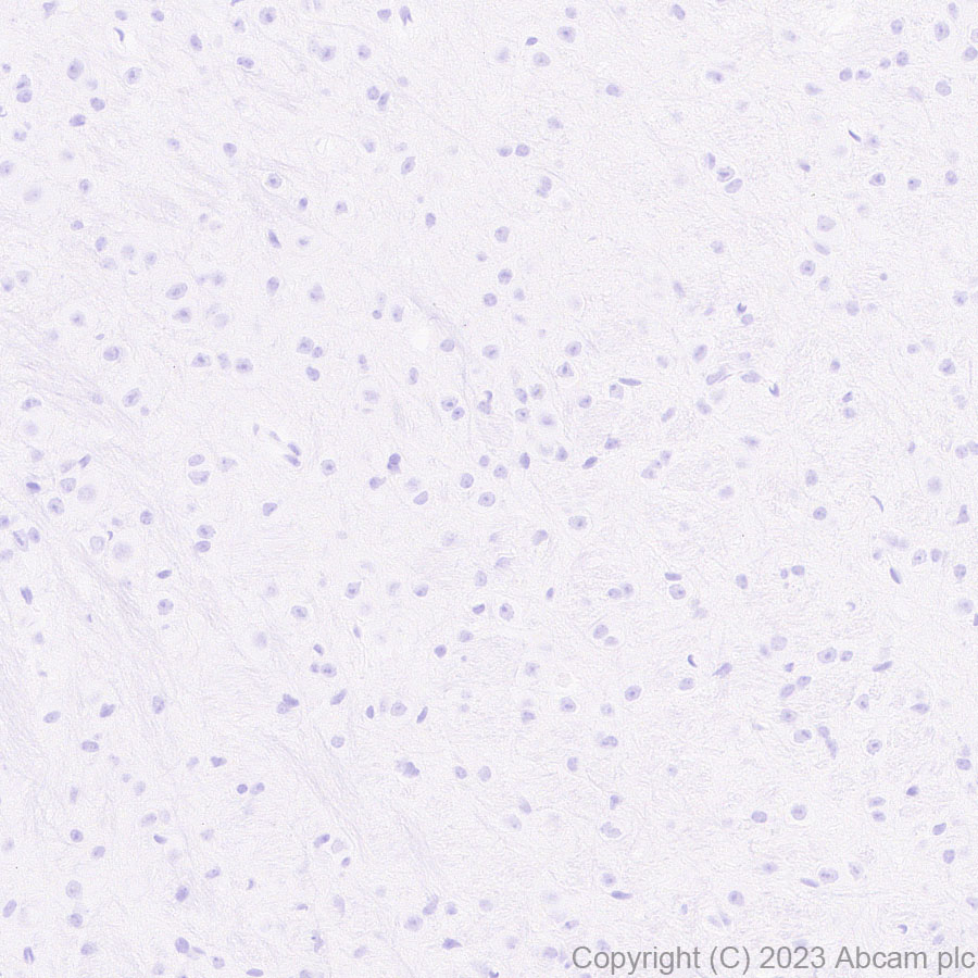 Immunohistochemistry (Formalin/PFA-fixed paraffin-embedded sections) - Anti-Cytokeratin 1 + Cytokeratin 2e antibody [EPR27257-91] (AB315228), expandable thumbnail
