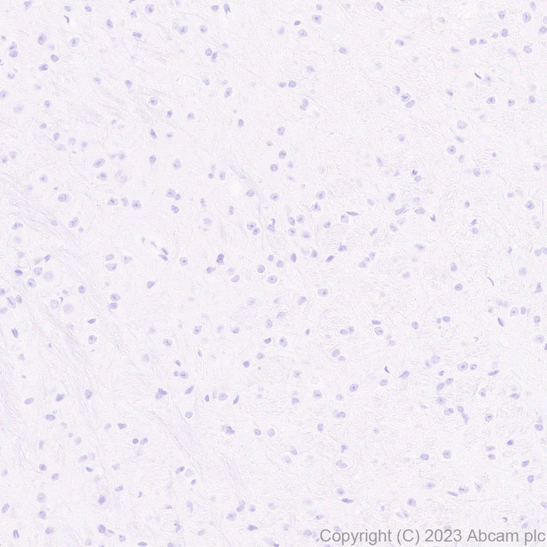 Immunohistochemistry (Formalin/PFA-fixed paraffin-embedded sections) - Anti-Cytokeratin 1 + Cytokeratin 2e antibody [EPR27257-91] (AB315228)