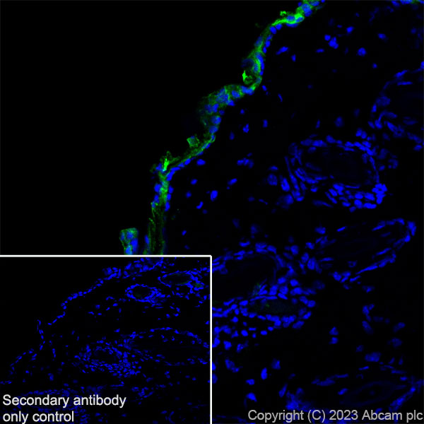 Immunohistochemistry (Frozen sections) - Anti-Cytokeratin 1 + Cytokeratin 2e antibody [EPR27257-91] (AB315228), expandable thumbnail