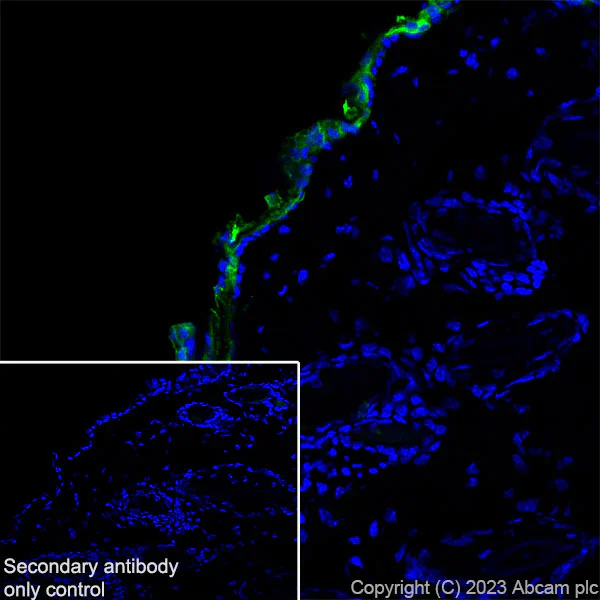 Immunohistochemistry (Frozen sections) - Anti-Cytokeratin 1 + Cytokeratin 2e antibody [EPR27257-91] (AB315228)