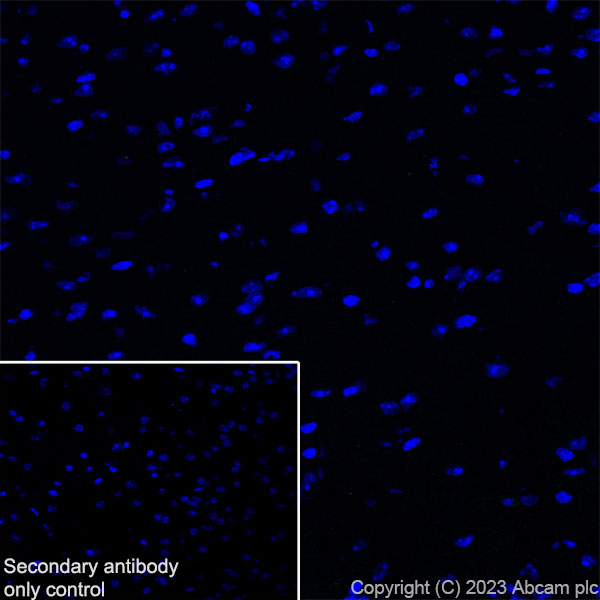 Immunohistochemistry (Frozen sections) - Anti-Cytokeratin 1 + Cytokeratin 2e antibody [EPR27257-91] (AB315228), expandable thumbnail