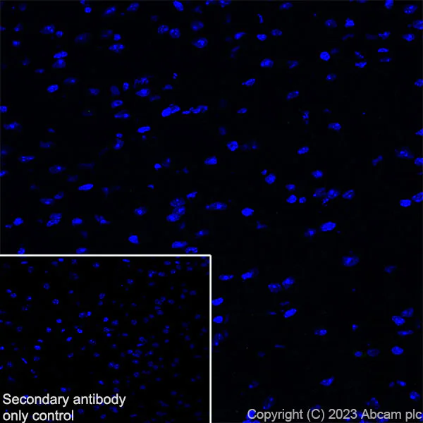 Immunohistochemistry (Frozen sections) - Anti-Cytokeratin 1 + Cytokeratin 2e antibody [EPR27257-91] (AB315228)