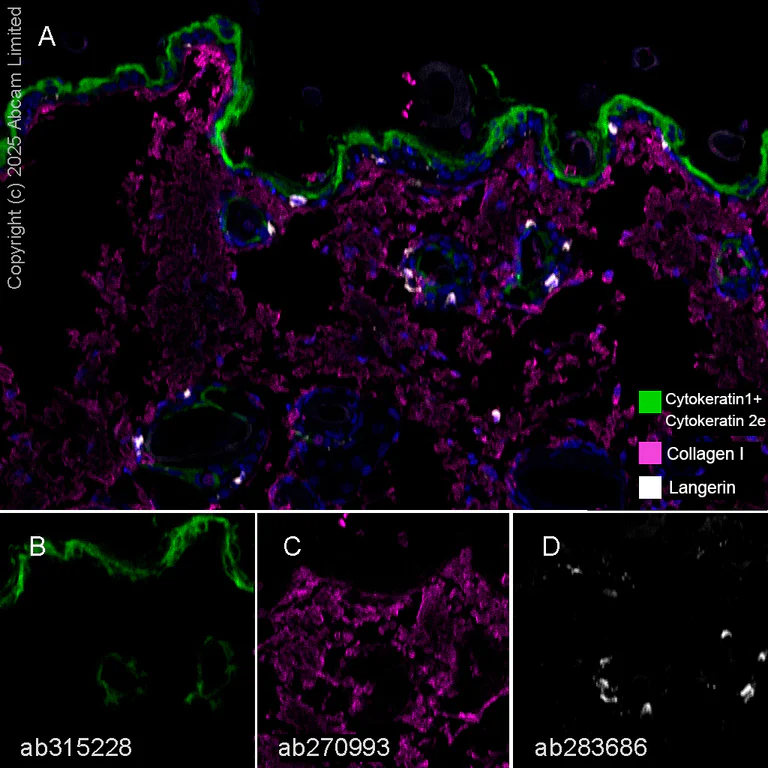 Multiplex immunohistochemistry - Anti-Cytokeratin 1 + Cytokeratin 2e antibody [EPR27257-91] (AB315228)