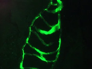 Immunohistochemistry (Frozen sections) - Anti-Cytokeratin 10 + 13 antibody [DE-K13] (AB9383)