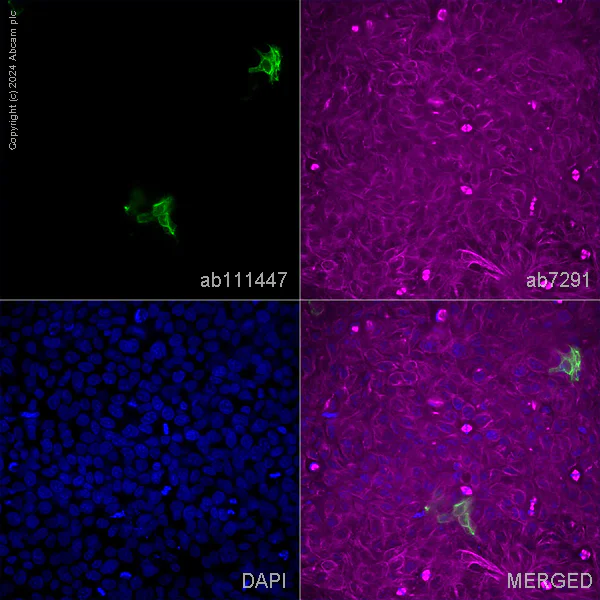 Immunocytochemistry/ Immunofluorescence - Anti-Cytokeratin 10 antibody (AB111447)