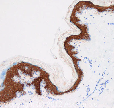 Immunohistochemistry (Formalin/PFA-fixed paraffin-embedded sections) - Anti-Cytokeratin 10 antibody (AB111447)