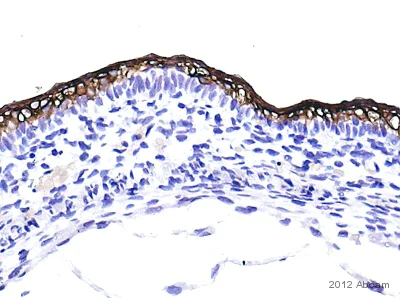 Immunohistochemistry (Formalin/PFA-fixed paraffin-embedded sections) - Anti-Cytokeratin 10 antibody (AB111447)