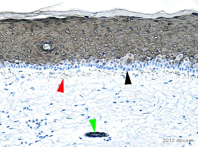 Immunohistochemistry (Formalin/PFA-fixed paraffin-embedded sections) - Anti-Cytokeratin 10 antibody (AB111447)