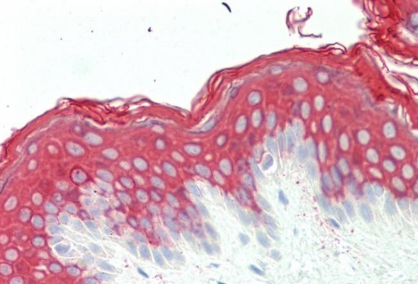 Immunohistochemistry (Formalin/PFA-fixed paraffin-embedded sections) - Anti-Cytokeratin 10 antibody (AB230801)