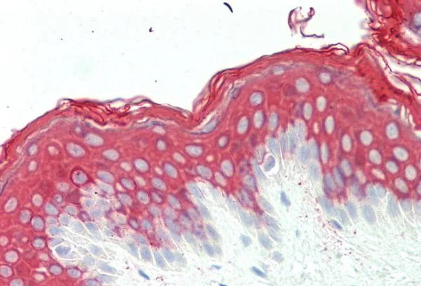 Immunohistochemistry (Formalin/PFA-fixed paraffin-embedded sections) - Anti-Cytokeratin 10 antibody (AB230801)