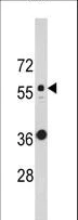 Western blot - Anti-Cytokeratin 10 antibody (AB230801)