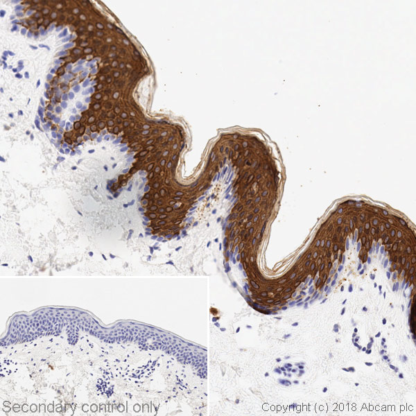 Immunohistochemistry (Formalin/PFA-fixed paraffin-embedded sections) - Anti-Cytokeratin 10 antibody [AE20] (AB237775)