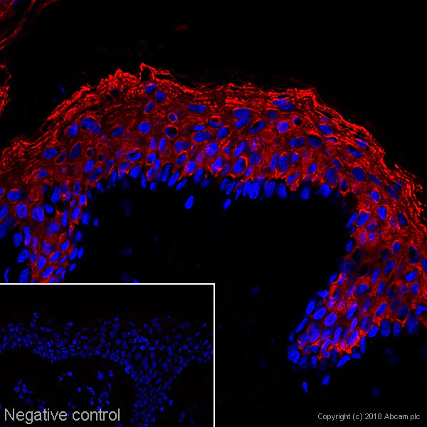 Immunohistochemistry (Frozen sections) - Anti-Cytokeratin 10 antibody [AE20] (AB237775)