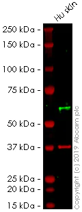 Western blot - Anti-Cytokeratin 10 antibody [AE20] (AB237775)