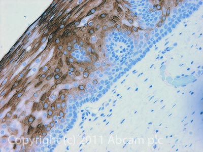 Immunohistochemistry (Formalin/PFA-fixed paraffin-embedded sections) - Anti-Cytokeratin 10 antibody [DE-K10] - Cytoskeleton Marker (AB9026), expandable thumbnail