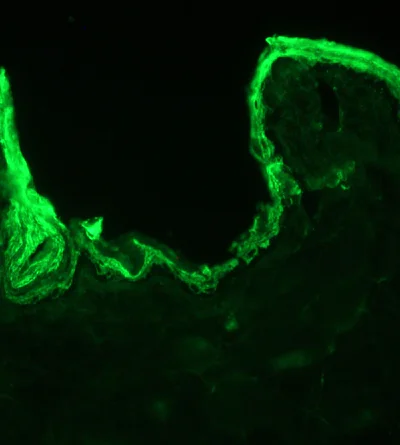 Immunohistochemistry (Frozen sections) - Anti-Cytokeratin 10 antibody [DE-K10] - Cytoskeleton Marker (AB9026)