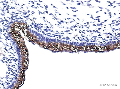 Immunohistochemistry (Formalin/PFA-fixed paraffin-embedded sections) - Anti-Cytokeratin 10 antibody [EP1607IHCY] - BSA and Azide free (AB220806)