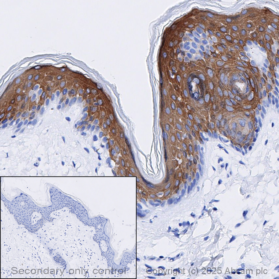 Immunohistochemistry (Formalin/PFA-fixed paraffin-embedded sections) - Anti-Cytokeratin 10 antibody [EP1607IHCY] - BSA and Azide free (AB220806)