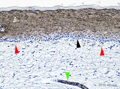 Immunohistochemistry (Formalin/PFA-fixed paraffin-embedded sections) - Anti-Cytokeratin 10 antibody [EP1607IHCY] - BSA and Azide free (AB220806)