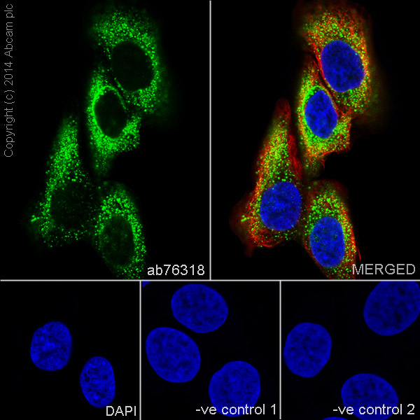 Immunocytochemistry/ Immunofluorescence - Anti-Cytokeratin 10 antibody [EP1607IHCY] - Cytoskeleton Marker (AB76318), expandable thumbnail