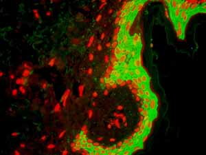 Immunohistochemistry (Formalin/PFA-fixed paraffin-embedded sections) - Anti-Cytokeratin 10 antibody [EP1607IHCY] - Cytoskeleton Marker (ab76318), expandable thumbnail