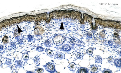 Immunohistochemistry (Formalin/PFA-fixed paraffin-embedded sections) - Anti-Cytokeratin 10 antibody [EP1607IHCY] - Cytoskeleton Marker (AB76318), expandable thumbnail