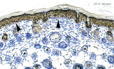 Immunohistochemistry (Formalin/PFA-fixed paraffin-embedded sections) - Anti-Cytokeratin 10 antibody [EP1607IHCY] - Cytoskeleton Marker (AB76318)