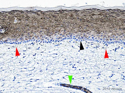Immunohistochemistry (Formalin/PFA-fixed paraffin-embedded sections) - Anti-Cytokeratin 10 antibody [EP1607IHCY] - Cytoskeleton Marker (AB76318)