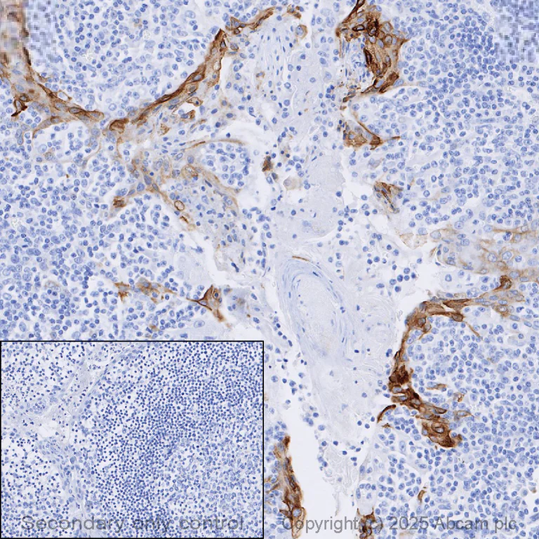 Immunohistochemistry (Formalin/PFA-fixed paraffin-embedded sections) - Anti-Cytokeratin 10 antibody [EP1607IHCY] - Cytoskeleton Marker (AB76318)