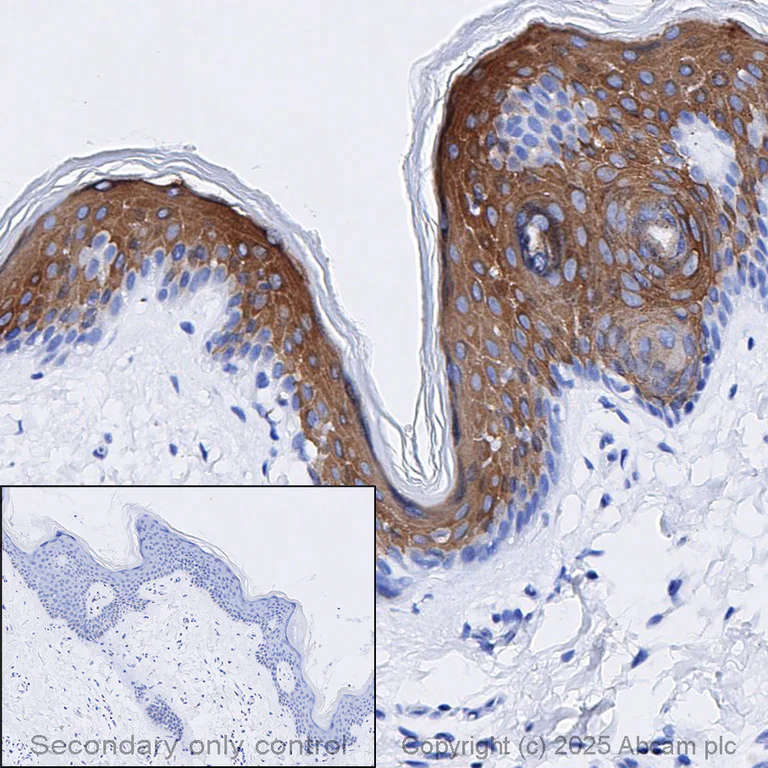 Immunohistochemistry (Formalin/PFA-fixed paraffin-embedded sections) - Anti-Cytokeratin 10 antibody [EP1607IHCY] - Cytoskeleton Marker (AB76318)