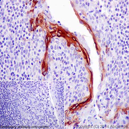 Immunohistochemistry (Formalin/PFA-fixed paraffin-embedded sections) - Anti-Cytokeratin 10 antibody [EP1607IHCY] - Cytoskeleton Marker (AB76318), expandable thumbnail