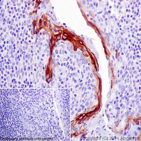 Immunohistochemistry (Formalin/PFA-fixed paraffin-embedded sections) - Anti-Cytokeratin 10 antibody [EP1607IHCY] - Cytoskeleton Marker (AB76318)