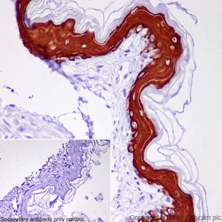 Immunohistochemistry (Formalin/PFA-fixed paraffin-embedded sections) - Anti-Cytokeratin 10 antibody [EP1607IHCY] - Cytoskeleton Marker (AB76318)