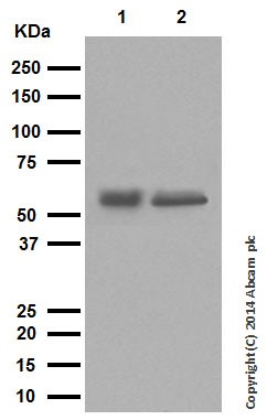 Western blot - Anti-Cytokeratin 10 antibody [EP1607IHCY] - Cytoskeleton Marker (AB76318), expandable thumbnail
